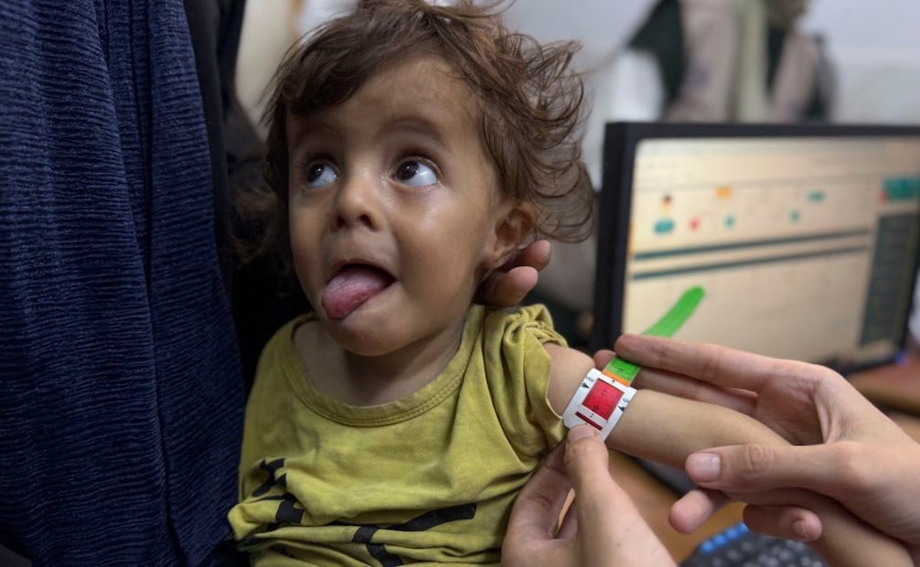 El Hospital de la Sociedad Benéfica de Amigos del Paciente de Ciudad de Gaza está atestado de madres ojerosas y niños cabezudos con cuerpos demasiado pequeños; ojos hundidos, tripas hinchadas y brazos diminutos. Es el único centro pediátrico que trata la desnutrición en el norte de la Franja, donde la hambruna se cobra cada día más vidas, la mayoría de niños. Foto: EFE