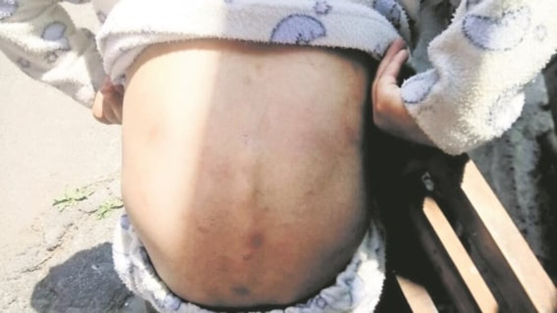 Beto, el niño de 6 años que fue torturado por su tía en Tlalpan