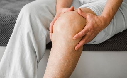 5 mitos sobre las várices que debes saber para un correcto tratamiento