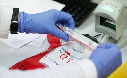 Casos de coronavirus en México, estado por estado al 6 de julio