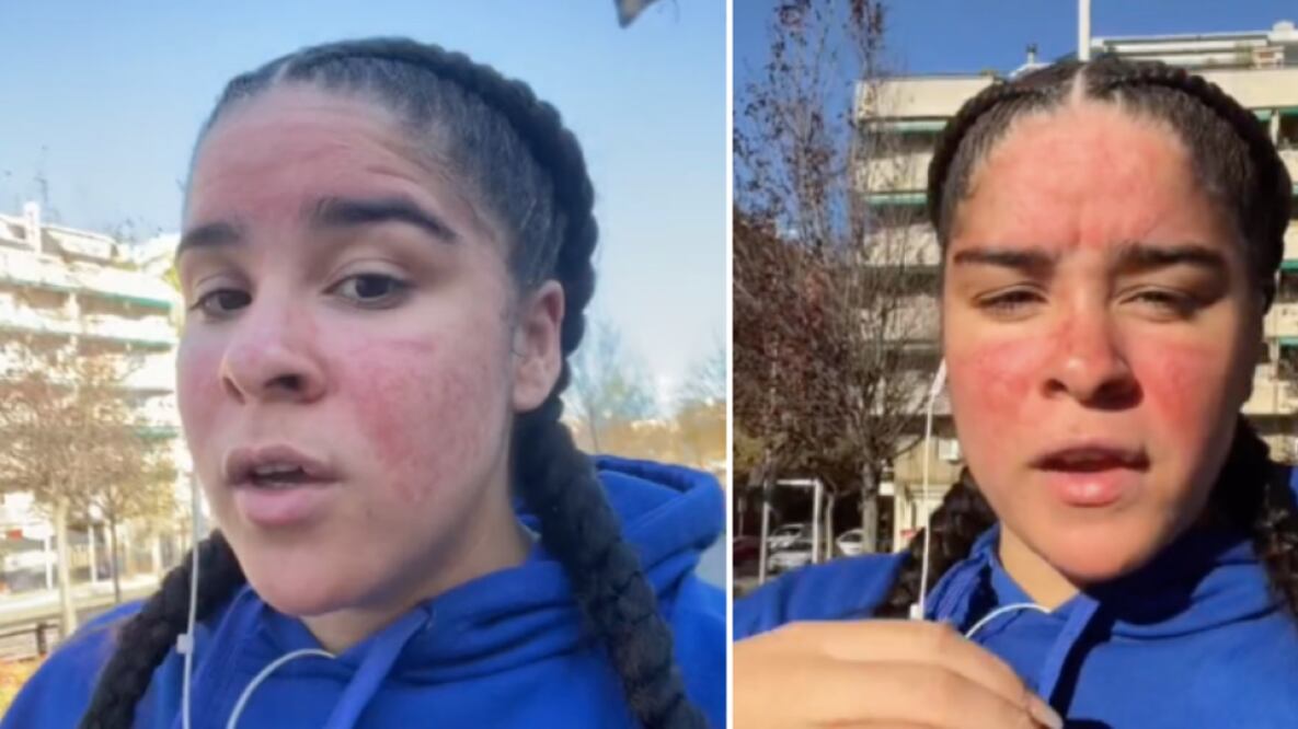 María Botella comenzó a tener reacciones alérgicas al agua, al sudor... aun así, es maestra de natación. FOTO: TikTok: @maria_ebm