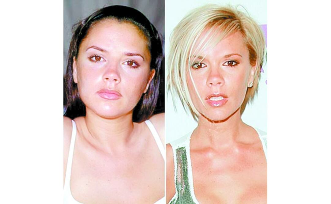 Victoria Beckham antes y después de cirugía plástica y aplicación de botox. Foto: Archivo El Universal