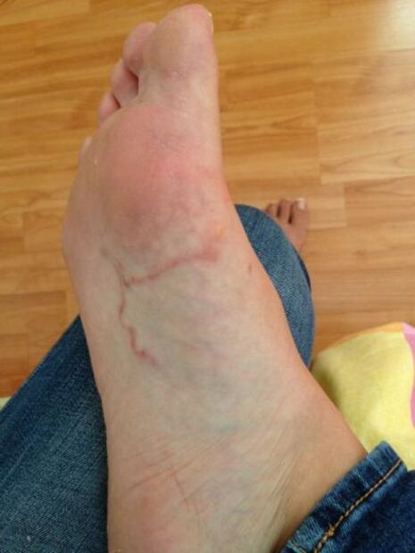 Tus mascotas te pueden pegar algunos parasitosis