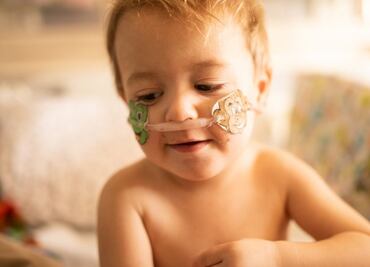 Por qué han aumentado drásticamente los casos entre niños de un virus respiratorio poco conocido