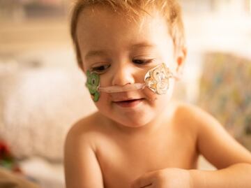 Por qué han aumentado drásticamente los casos entre niños de un virus respiratorio poco conocido