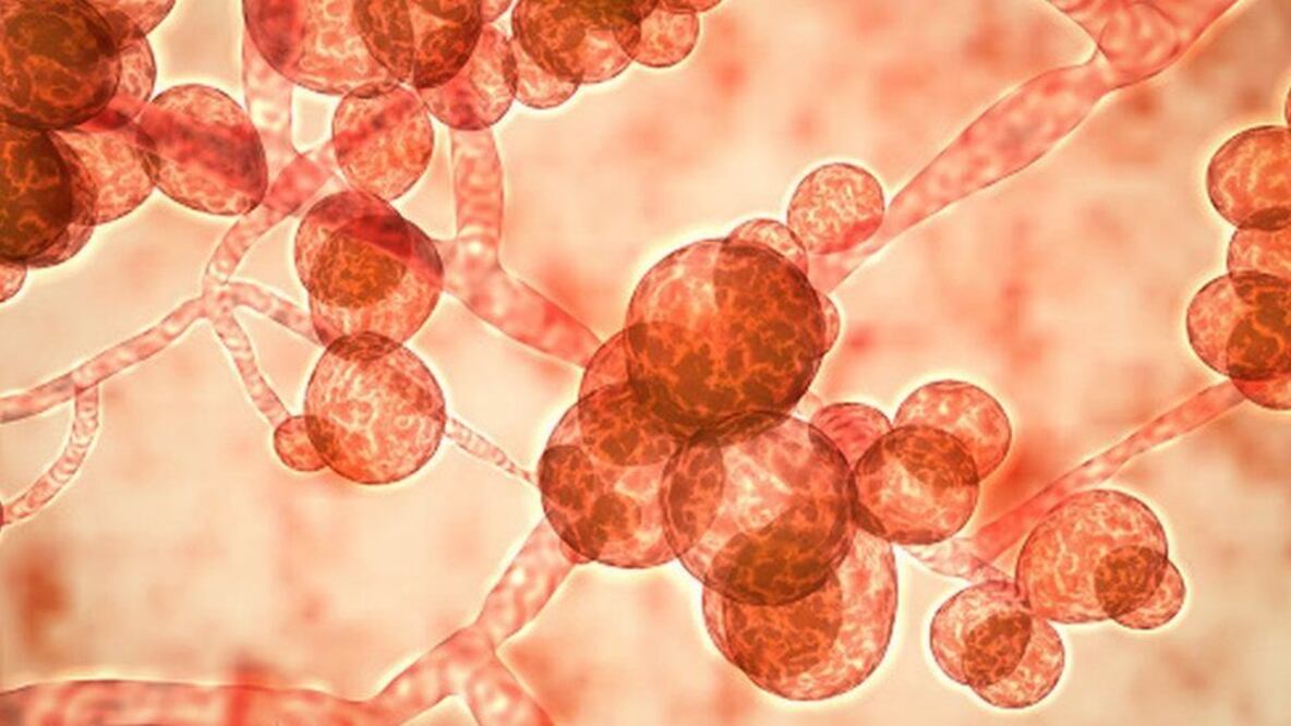 La C. auris es el hongo más detectado en las unidades de terapia intensiva en el mundo. Foto: Getty Images vía BBC