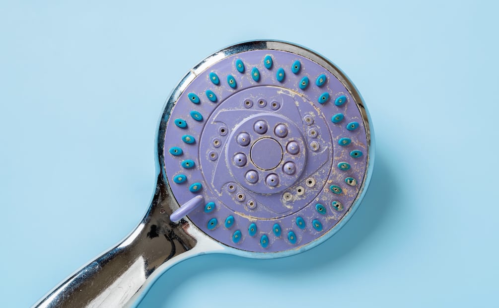 El sarro puede provocar daños en la piel y en el cuero cabelludo. Foto: Canva