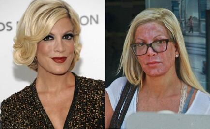 Tori Spelling ¡¿qué le pasó a su rostro?!