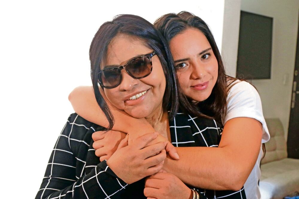 Tras sufrir el atentado con ácido por parte de su pareja, Carmen García creó una fundación que se encarga de recabar información, así como apoyar y dar voz a las víctimas de este tipo de ataques. Foto: Archivo | El Universal