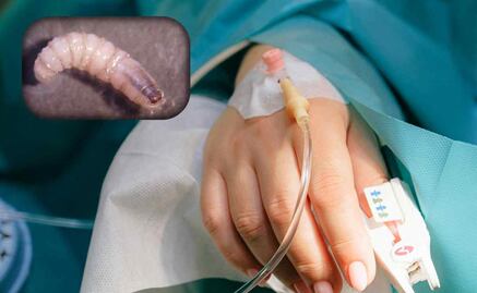 Detectan primera persona infectada con gusano barrenador en Yucatán