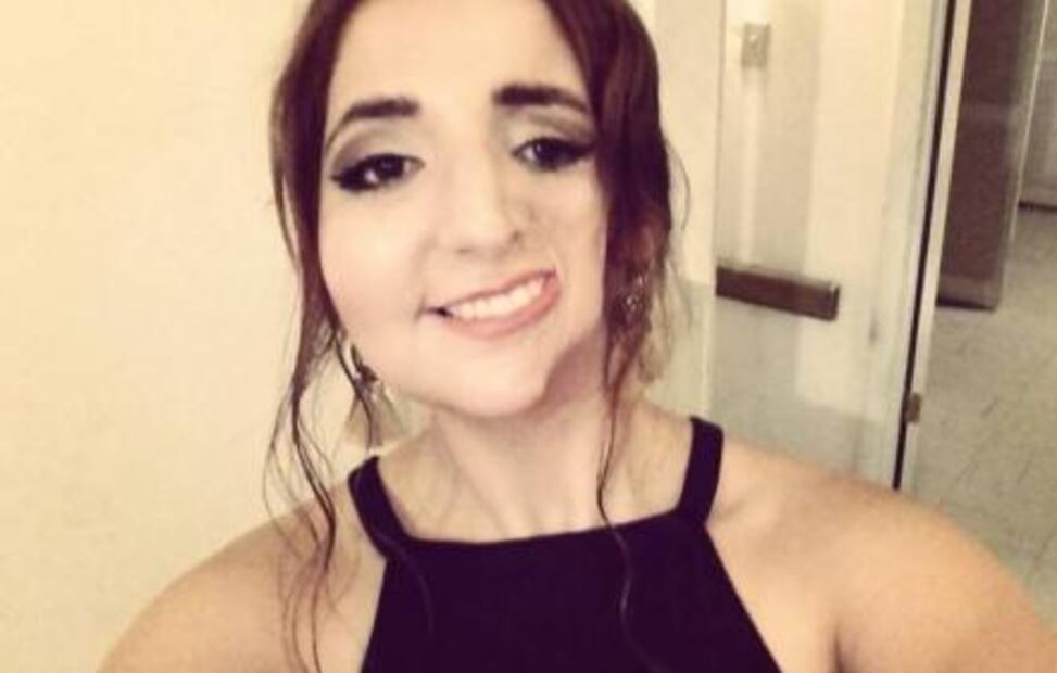 Con tacos, ayudan a Magaly para tratar enfermedad que desfigura el rostro