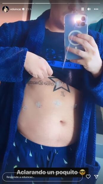 Eduin Caz muestra las heridas que le dejó intervención quirúrgica