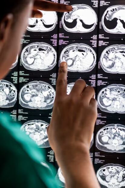 Cómo detectar un ACV. Fuente: Freepik