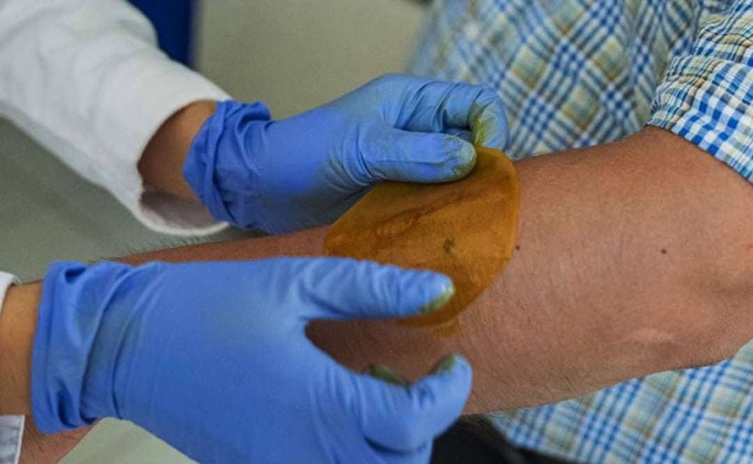 Researchers from the UNAM developed these patches - Photo: Courtesy of the UNAM