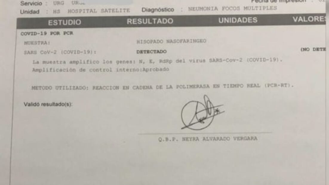 ¿Cuánto cuesta tratarse contra coronavirus? 200 mil pesos en hospital privado