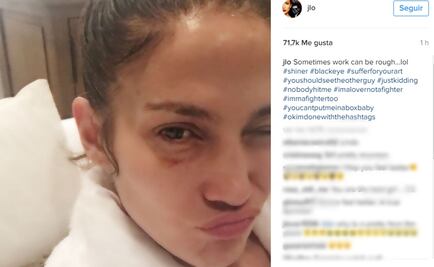 Jennifer Lopez publica foto con el ojo morado