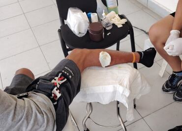 Migrante cubano enfermo por gusano barrenador pide ayuda a Sheinbaum; busca permiso para llegar a CDMX