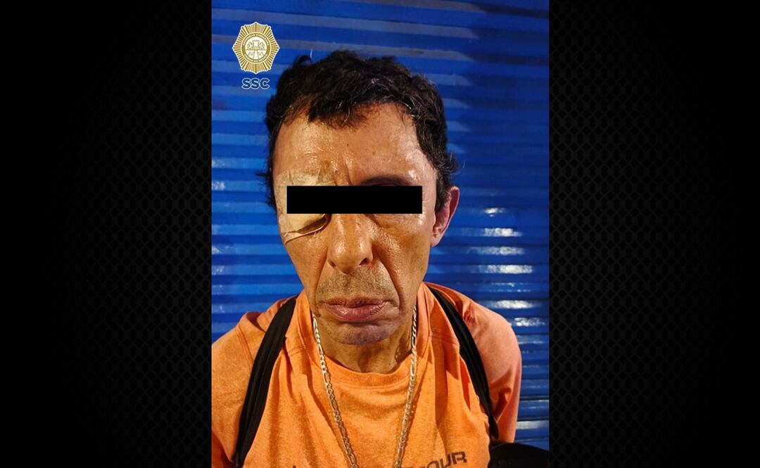 Detienen en Miguel Hidalgo a hombre con seis ingresos al penal por presunta venta de drogas. Foto: Especial