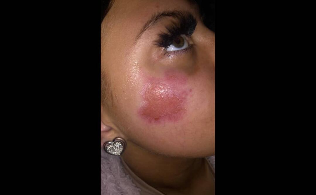 Foto: Facebook Amie Hall