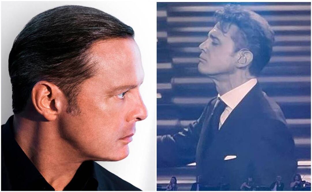 Cuestionan orejas de Luis Miguel. El cantante hace unos años y en su reciente concierto en Argentina.
