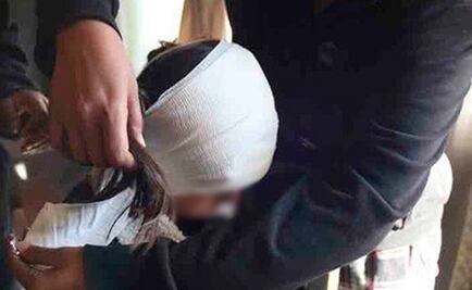 Perros pitbull atacan a niña de 10 años en Ciudad Juárez