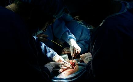 Realizan trasplante cruzado de rinón 