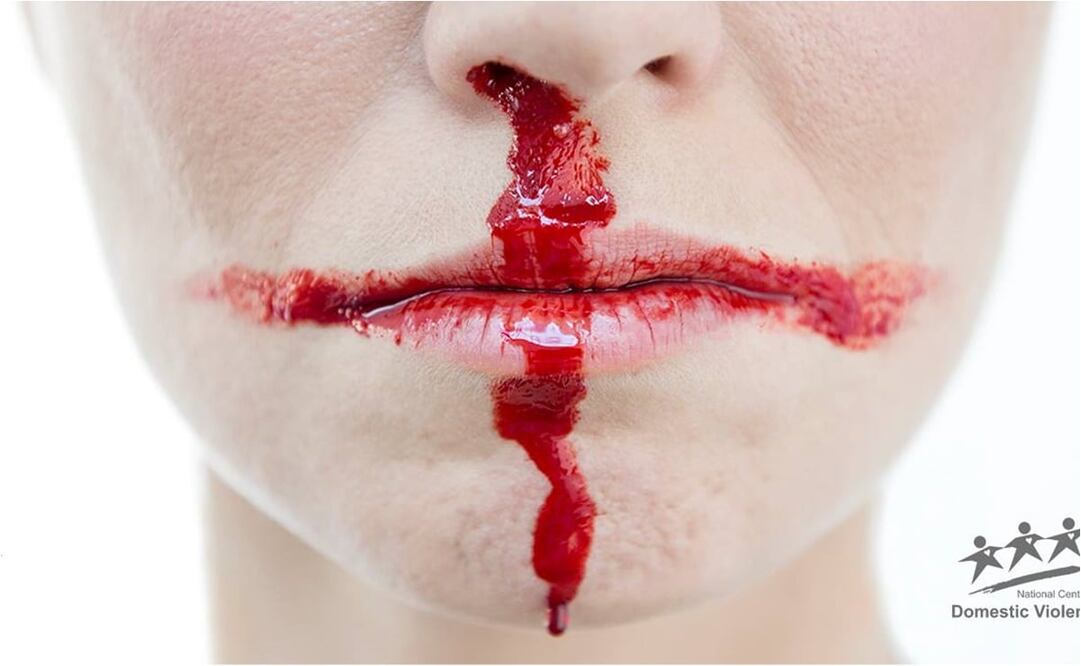 FOTO: @NCDV_Official