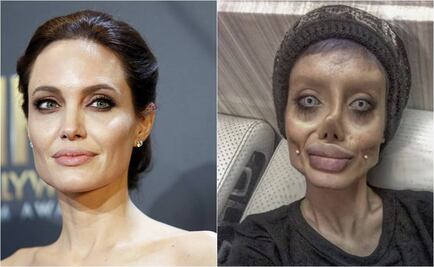 ¿Cincuenta cirugías para ser como Angelina Jolie?