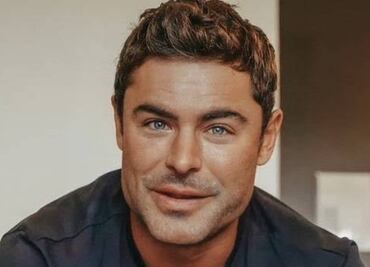 ¿Qué les pasó en la cara? Estos 5 artistas han recurrido a procedimientos estéticos