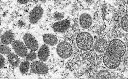 Viruela del mono: ¿Cuál es la población con mayor riesgo de contagio?