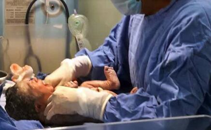 Itzel, la primer bebé del 2017 en la CDMX