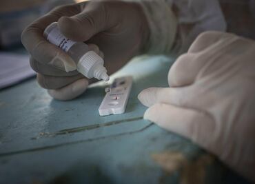 Sheinbaum alerta por ineficacia de pruebas serológicas para Covid en Álvaro Obregón