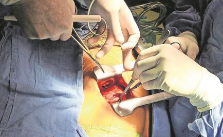 Desarrollan sistema robótico que ayuda al corazón a latir