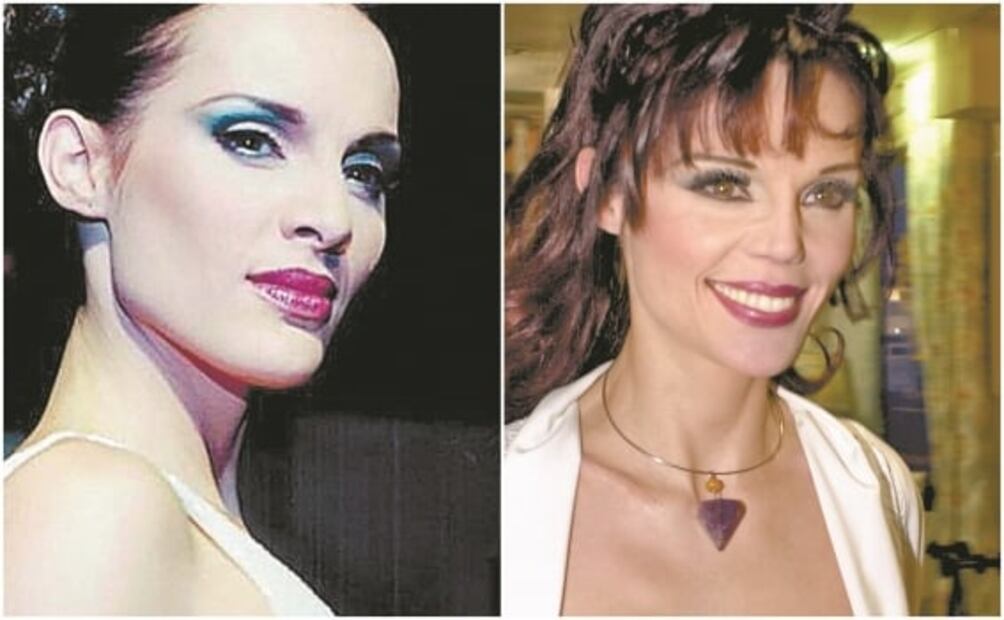 Famosos que recurren a la cirugía estética para ser mejores