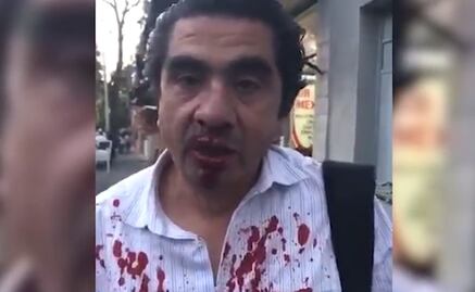 Golpean a reporteros en trifulca de morenistas y perredistas en Coyoacán