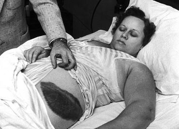 Ella es Ann Hodges, la única persona que ha sido golpeada por un meteorito