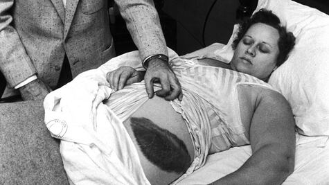 Ella es Ann Hodges, la única persona que ha sido golpeada por un meteorito