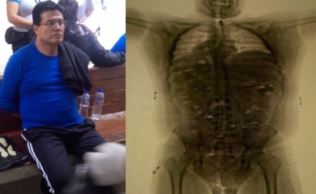 A todos se les encontraron sustancias extrañas con droga en el cuerpo. Foto: El Comercio Perú 