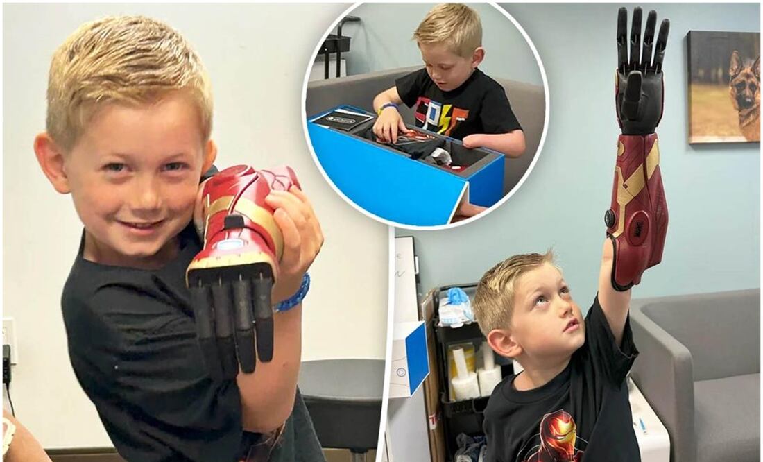 La historia del pequeño Jordan ha recorrido el mundo por tratarse de la primera persona más joven (con tan sólo 5 años), en obtener un brazo biónico al estilo Iron Man. Su madre declaró que esto le cambió la vida al pequeño. Foto: Tomada de X, antes Twitter