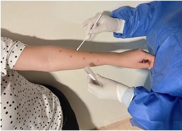 Confirman primer caso de Mpox en Baja California Sur; se trata de un hombre de 26 años