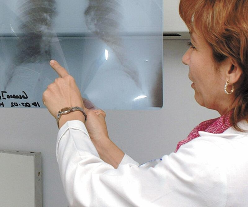 Padecimiento. La EPOC es una denominación para diversos padecimientos pulmonares que limitan el flujo de aire. Foto/ARCHIVO EL UNIVERSAL