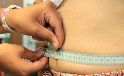 Por arriba del 70% problema de la obesidad en México