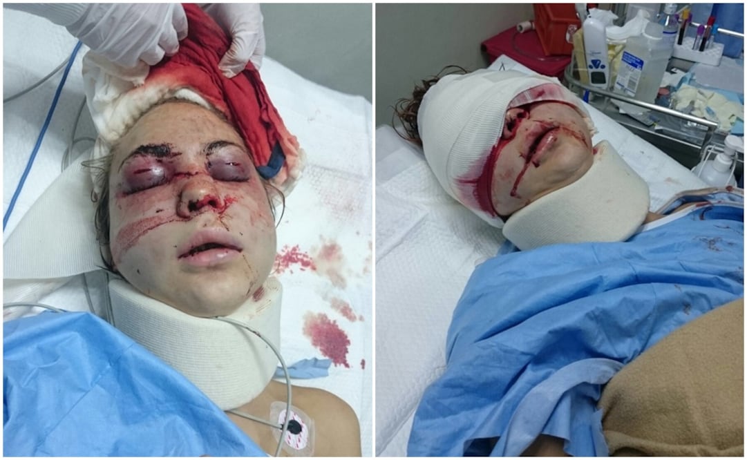 La hija de Ivanova estaba en proceso de divorcio con Alain Meder; ya había tenido antecedentes de agresión. FOTOS: Cortesía