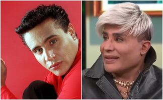 El antes y el después de Eduardo Antonio, el cantante y ex de Niurka, se hace la misma cirugía que Ninel Conde