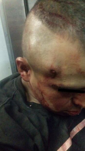 Atienden a herido con pistola dentro de Metro Romero Rubio