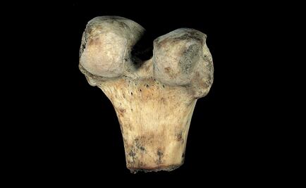 UNAM scientists use rice husk to create bone substitute