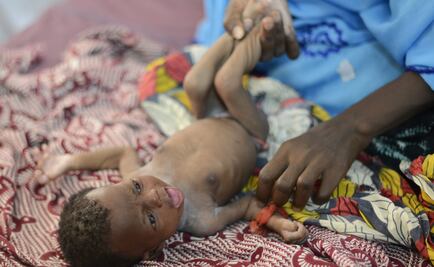 ​Más de 750 mil personas sufrirán la peor crisis alimentaria en Senegal, alertan