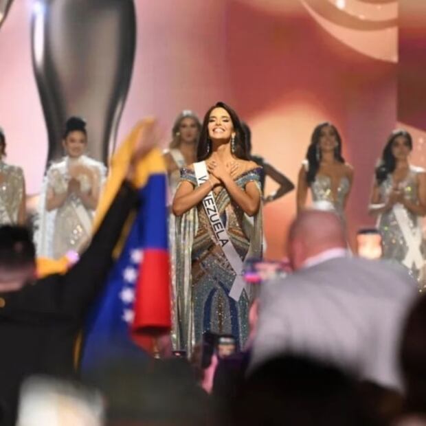 No podrás creer como lucía Amanda Dudamel, primera princesa de Miss Universo, antes de las cirugías