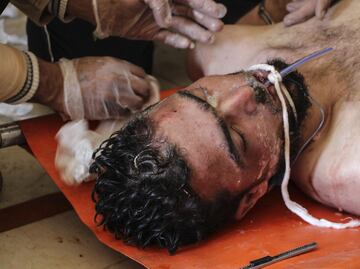 Rusia niega estar detrás del ataque químico en Siria