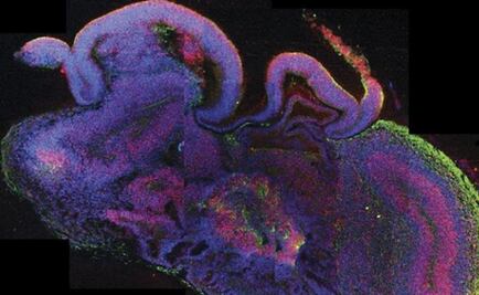 Crean nanosonda que permite registrar señales neuronales en médula espinal